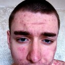 ���������� ���������, ���� ����� �����, 18 ���, ������������ ��� ������, ����� � ���������