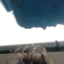  ,   Morquik, 22 ,   ,   