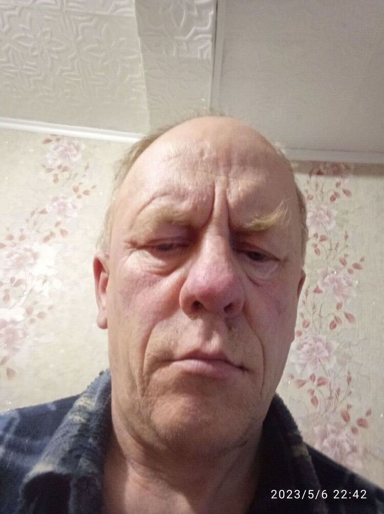  35761164  , 56 ,    