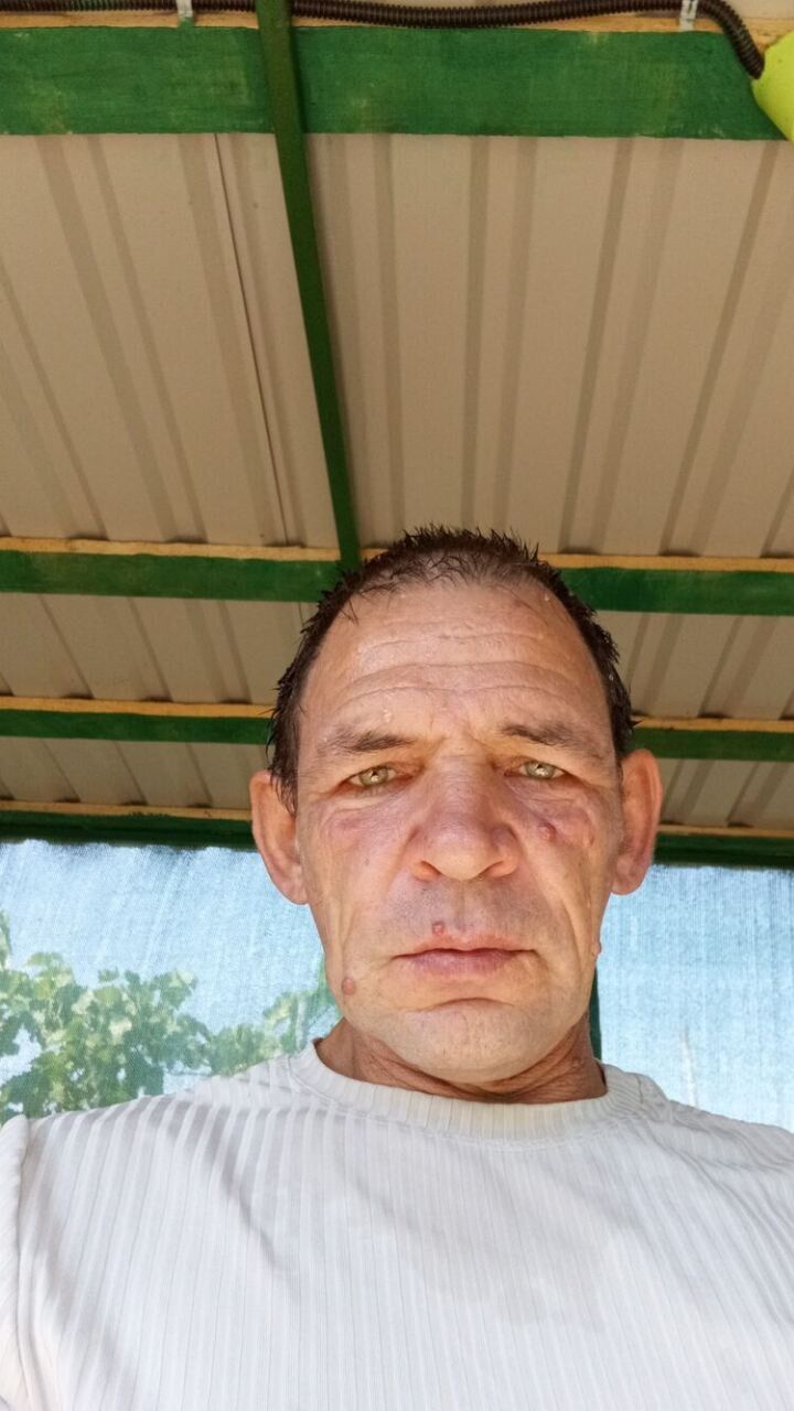  49932094  , 54 ,    