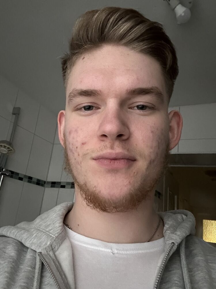  48367254  Dima, 19 ,    Marienberg