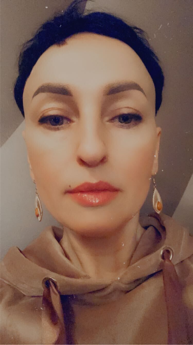  31613904  Mila, 44 ,    
