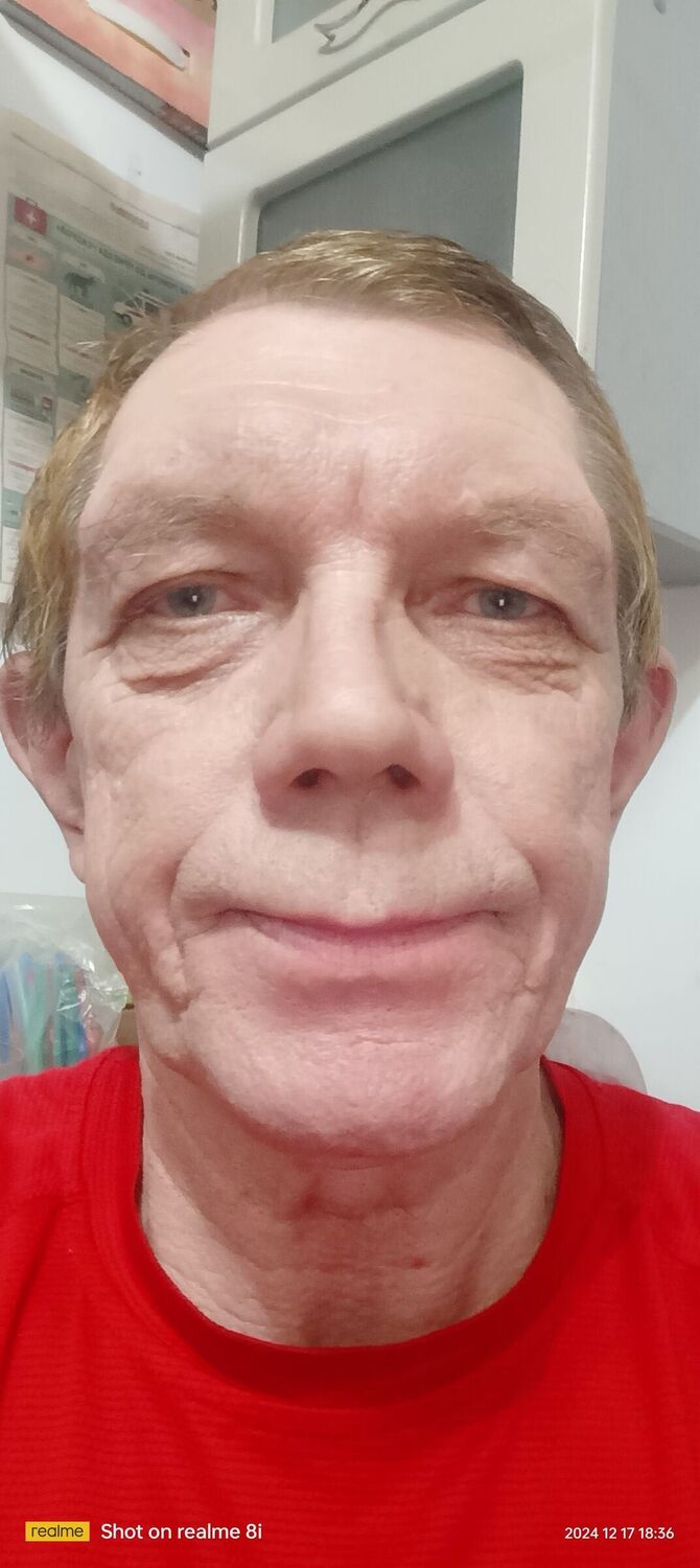 ���������� �������, ���� ������� ��������, 65 ���, ������������ 