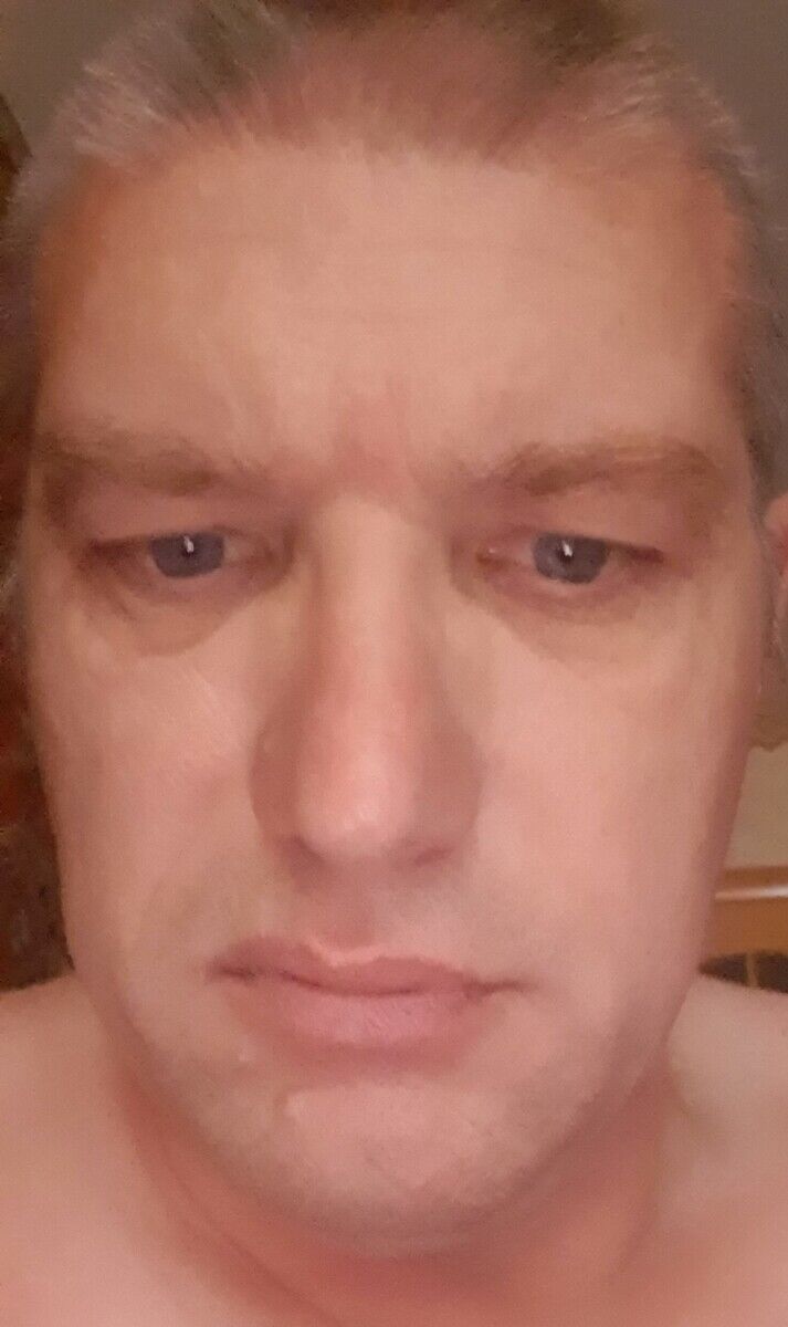  20315564  , 53 ,    
