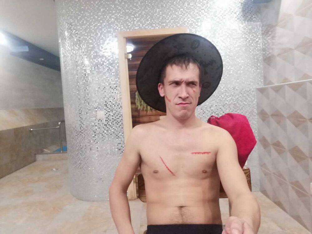  34363674  , 35 ,    