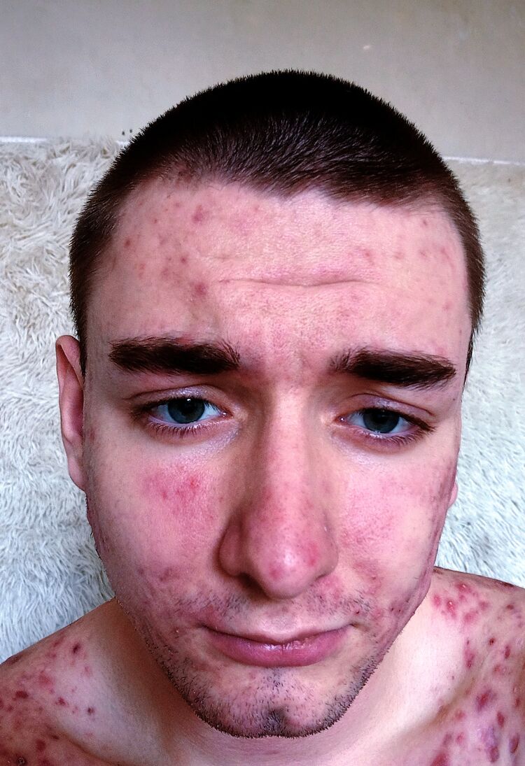 ���� 56326684 ����� �����, 18 ���, ���� ���������� � ����������