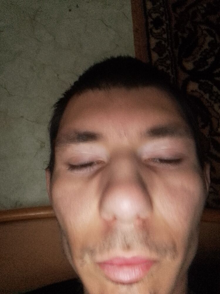  31644684  , 42 ,    