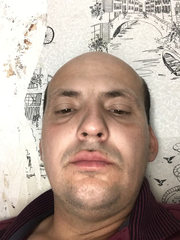  36837114  , 35 ,    
