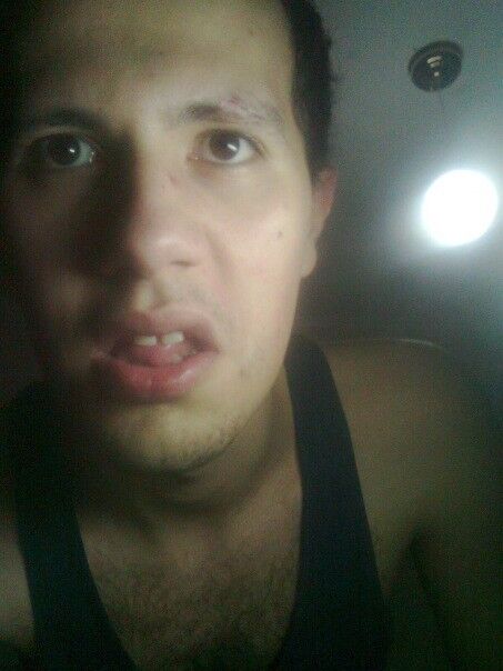 ���������� ������-��-����, ���� ������� ����, 36 ���, ������������ ��� ���������