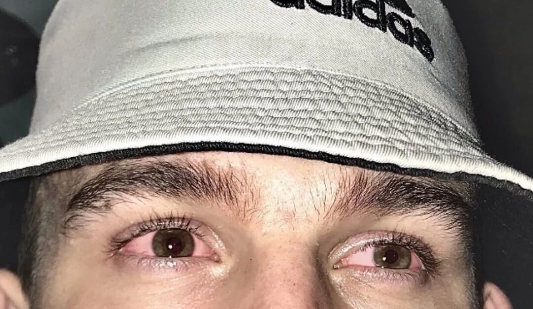  53634134  , 22 ,    --