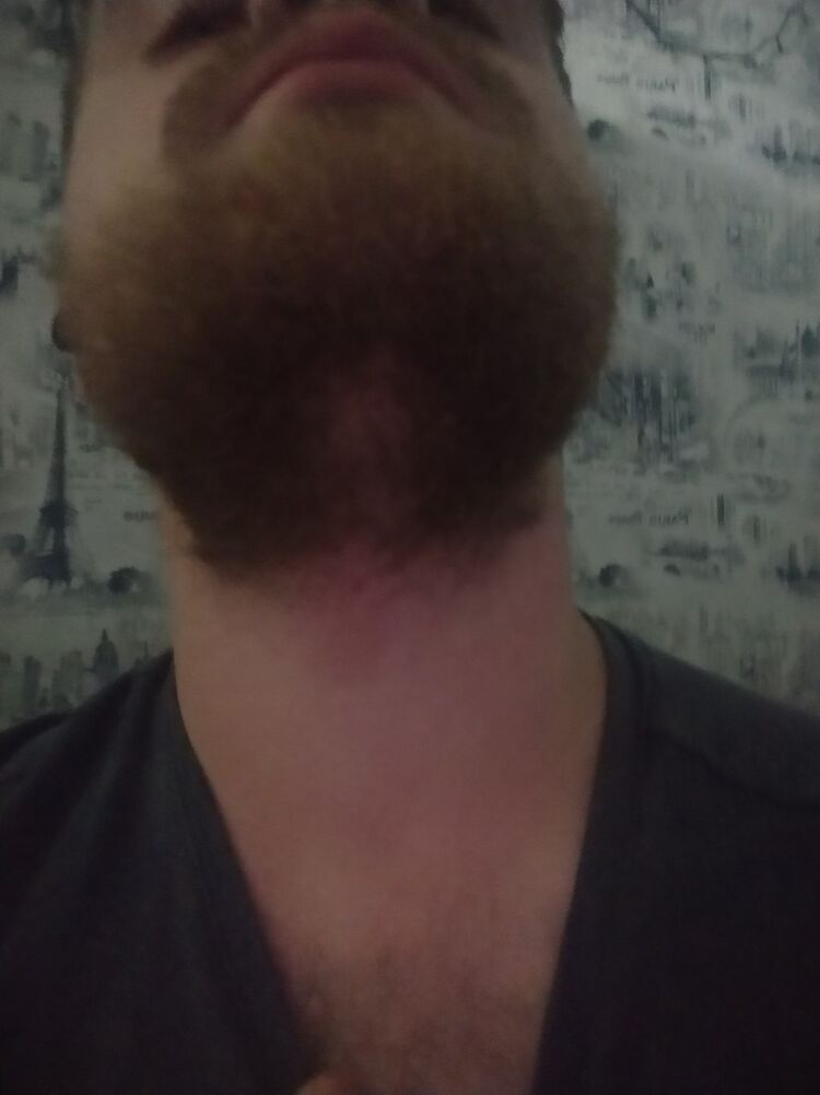  19053294  , 24 ,    
