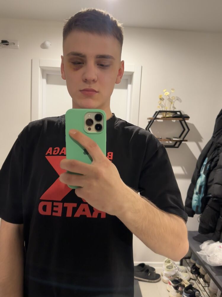  47127714  , 24 ,    
