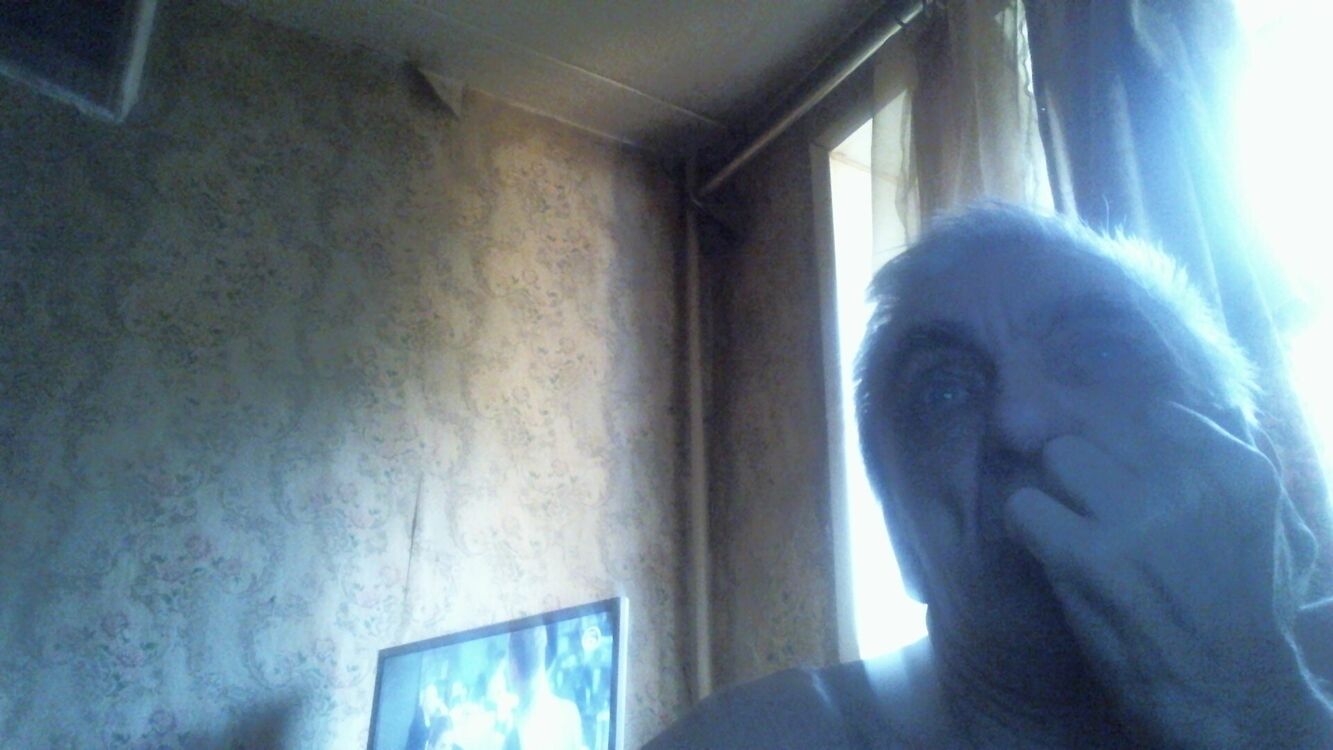  44340354  , 72 ,    