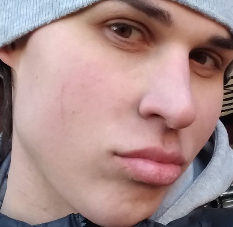  52799464  , 31 ,    Deleted