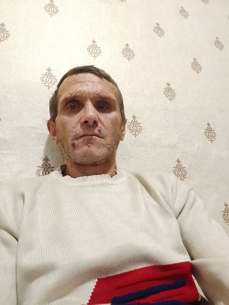  48517744  , 43 ,    