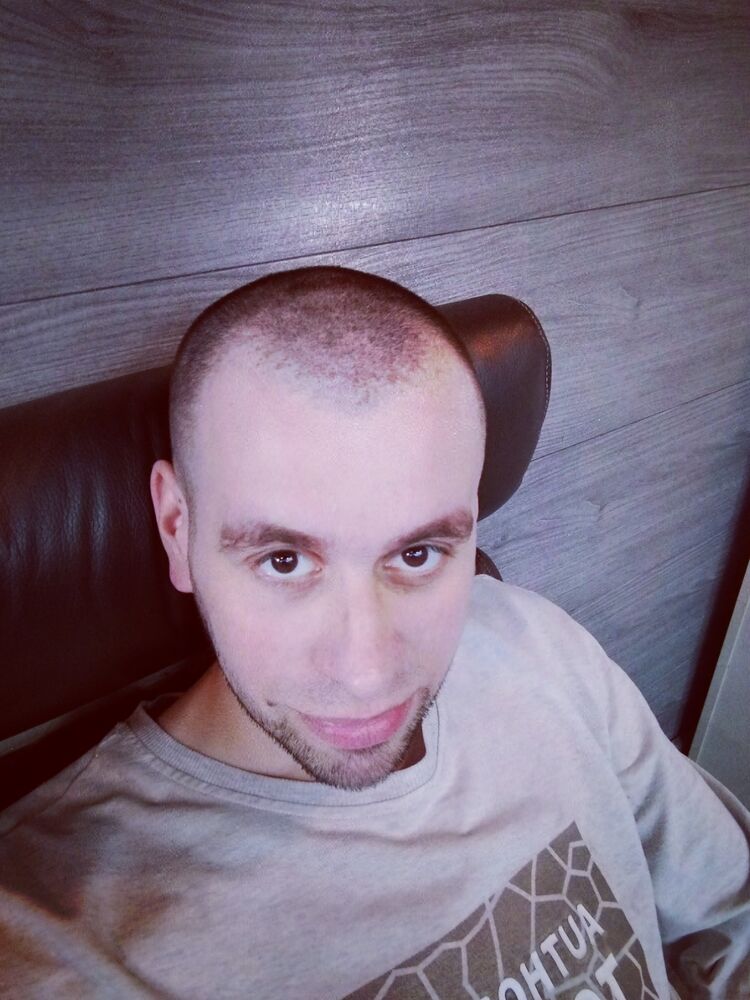  33659514  , 35 ,    -