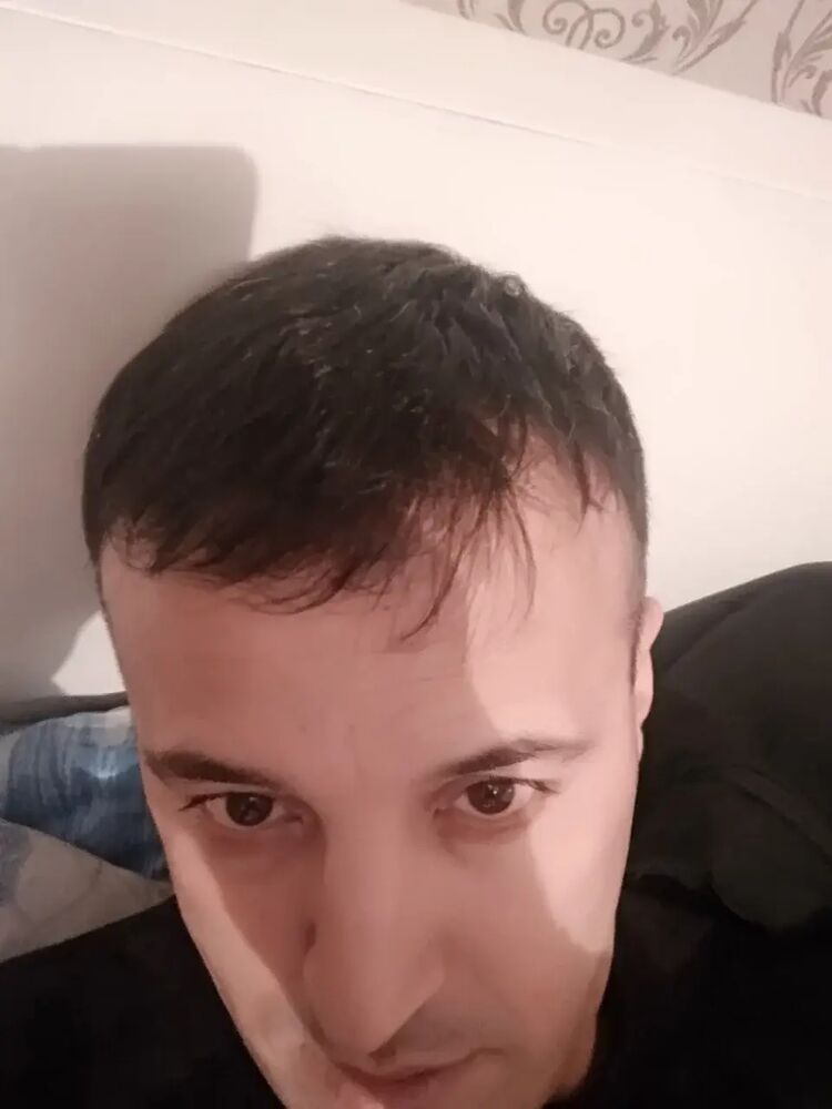  28407644  , 102 ,    