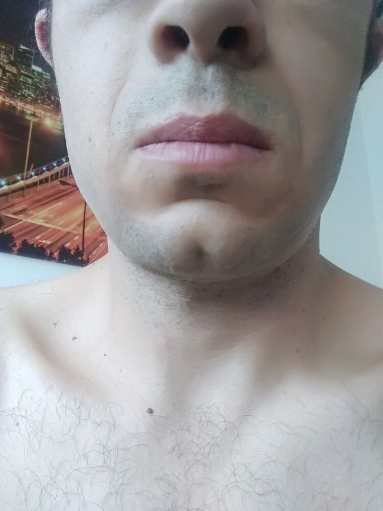  22968234  , 41 ,    