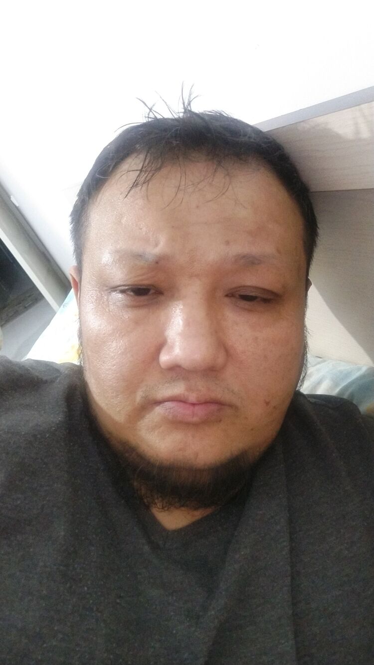  40938204  , 43 ,    