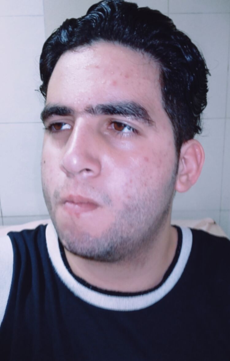  50306594  Felipe, 22 ,    