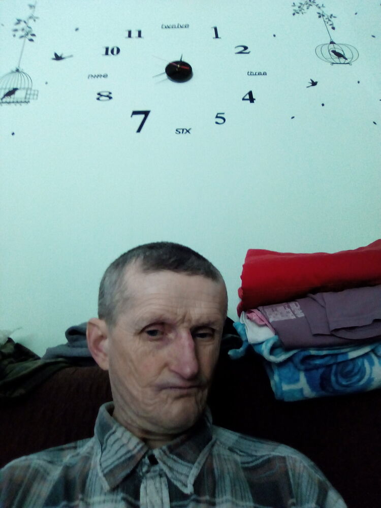  25354254  , 57 ,    