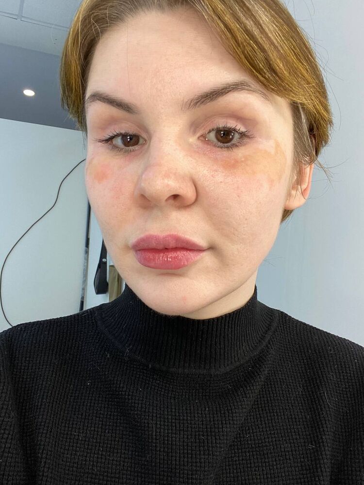 ���� 32916644 ������� �����, 35 ���, ���� ���������� � ���������