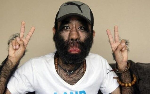 ���� 17485804 ������� �����, 35 ���, ���� ���������� � ������