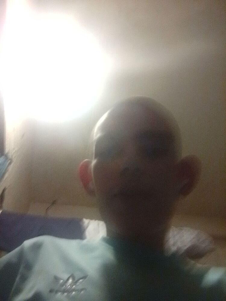  34848874  , 100 ,    