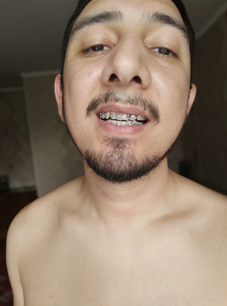  36732274  , 32 ,    