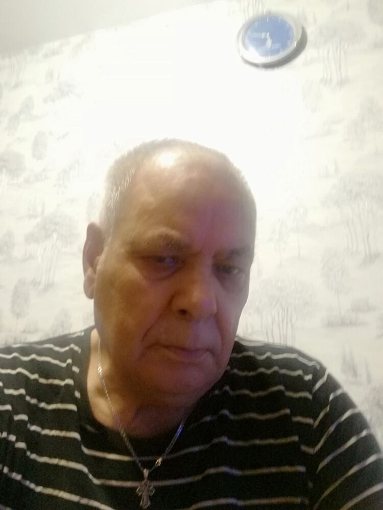  44355664  , 78 ,    