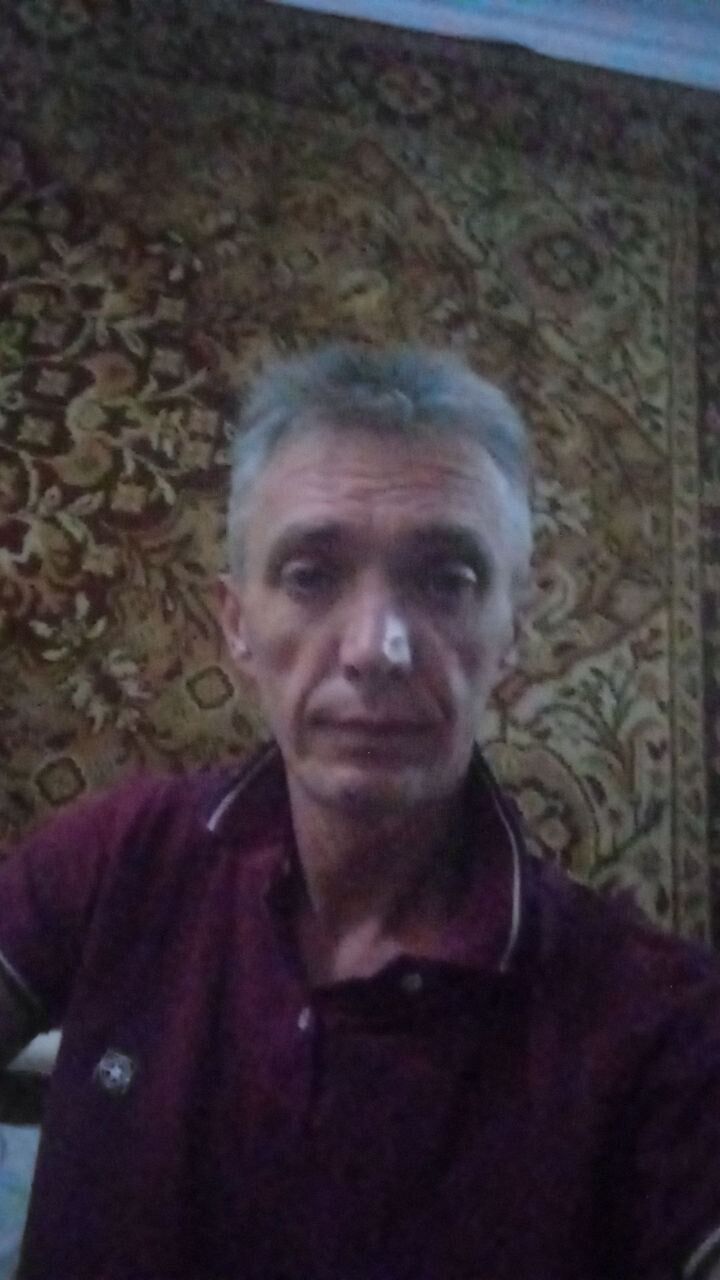  44431494  , 45 ,    