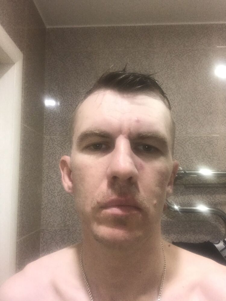 38258444  , 40 ,    