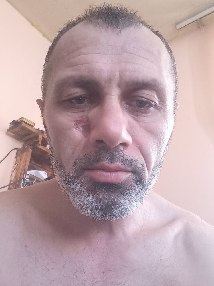 52784474  , 44 ,    