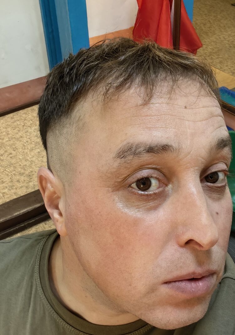 ���� 56228344 ������� ���������, 36 ���, ���� ���������� � ����