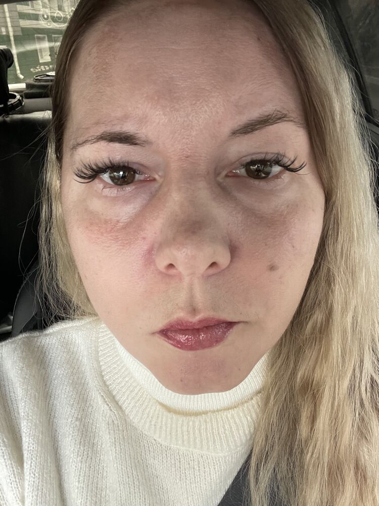 ���� 55156864 ������� �������, 36 ���, ���� ���������� � ������