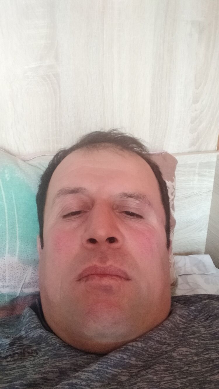 35044974  , 43 ,    