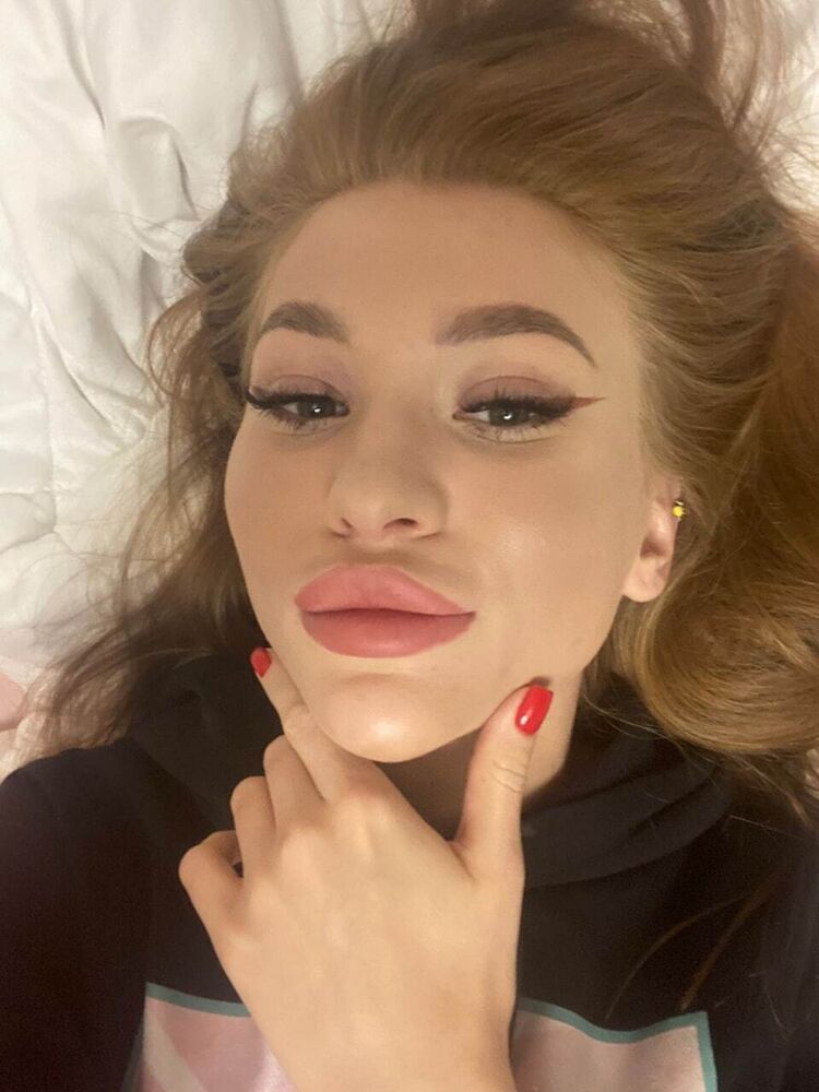  37718894  , 22 ,    -