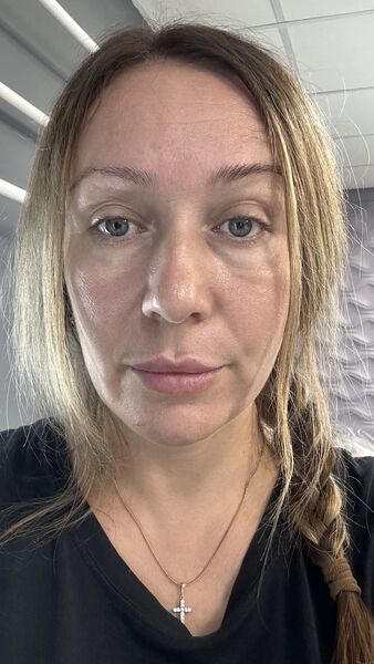  -,   , 45 ,  