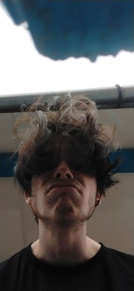  ,   Morquik, 22 ,   ,   