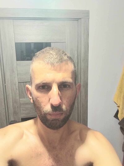  ,   Vitoss, 36 ,   ,   